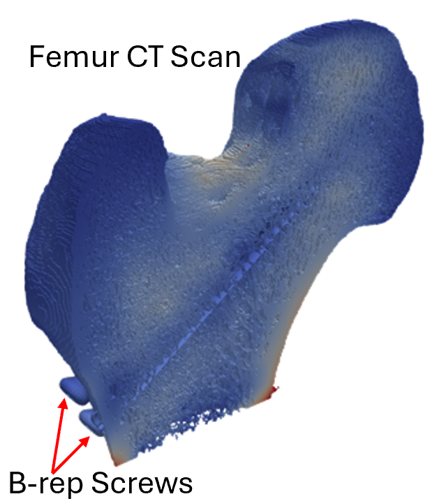 Femur CT